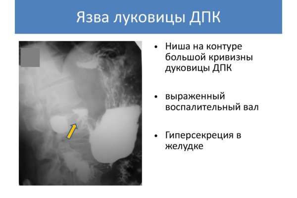 Кракен наркошоп